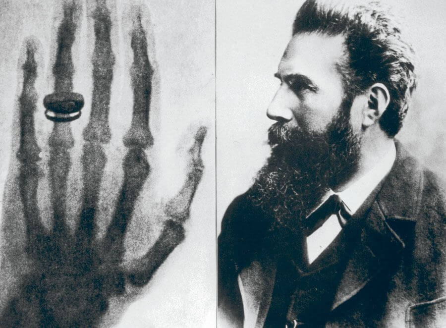x ray Wilhelm Röntgen