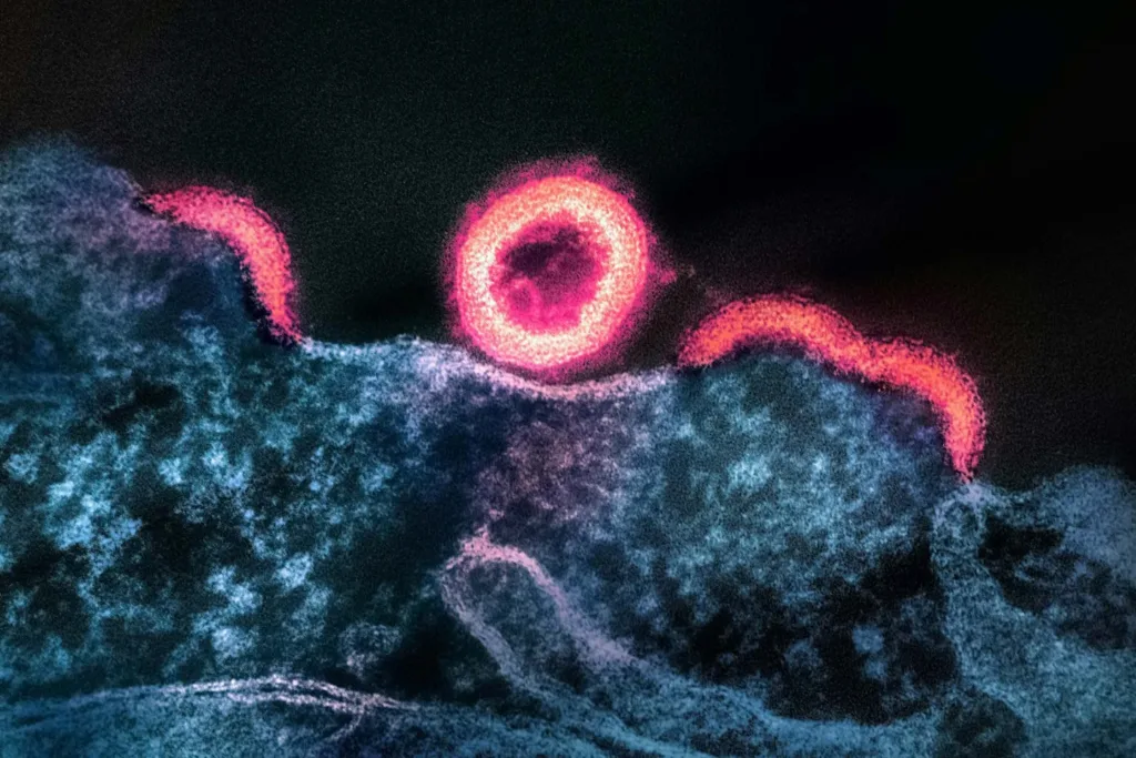 HIV