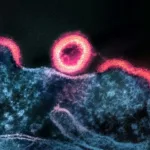 HIV
